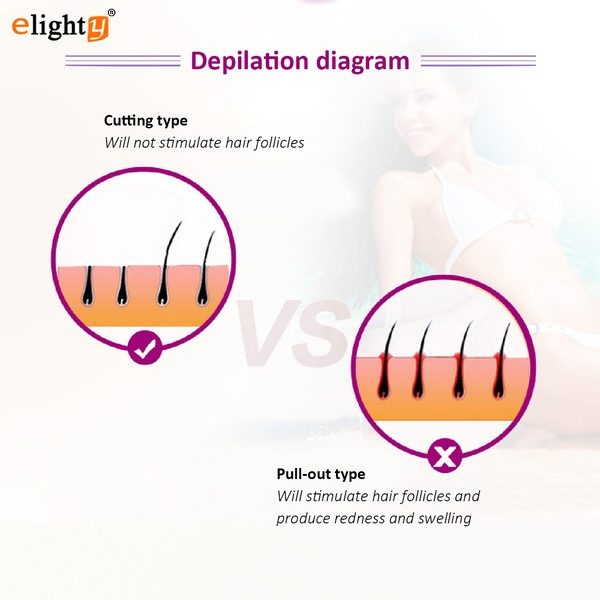 Elektromos vízálló epilátor öt csatlakozóval az arc és a test különböző részeihez lila és rózsaszín színben